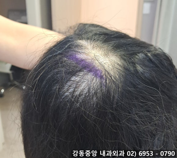 천보성 이미지