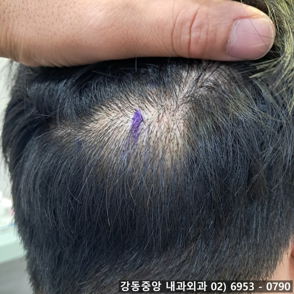 천보성 이미지