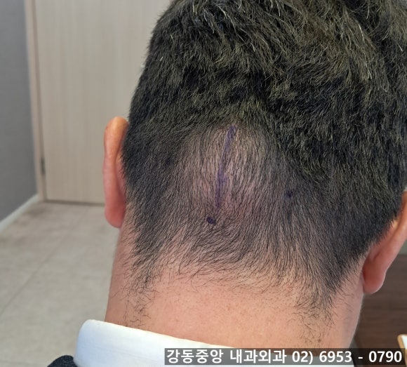 천보성 이미지