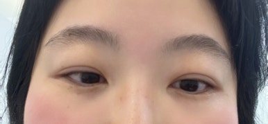 오늘도;예쁜EYE 이미지