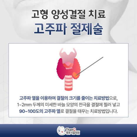 땡큐열쇠 이미지