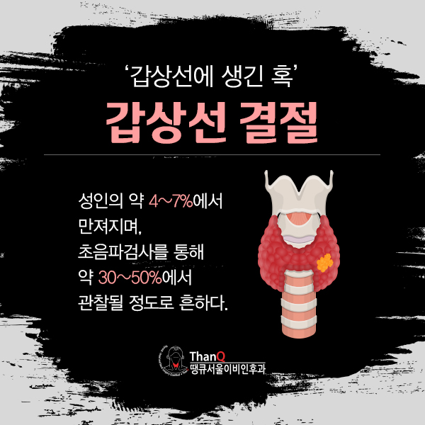 땡큐열쇠 이미지