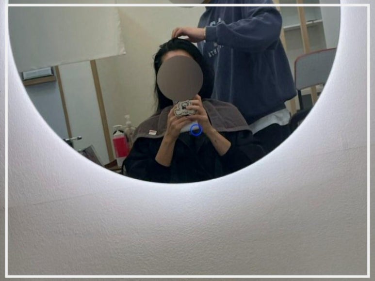 동탄탈모두피본연 이미지