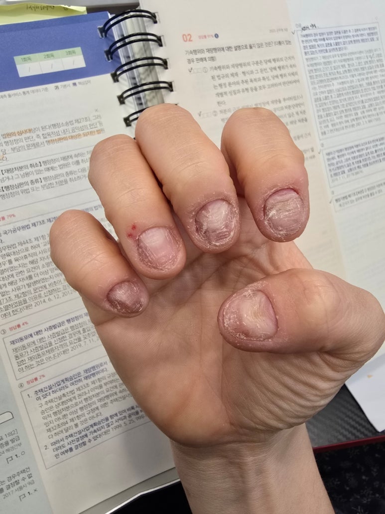 푸르네일 이미지