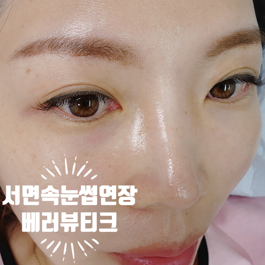눈뷰티크 이미지