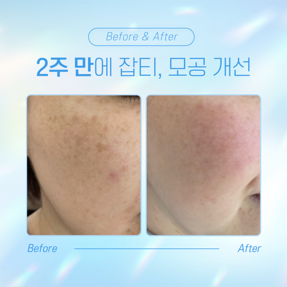 아이비에스테틱 이미지