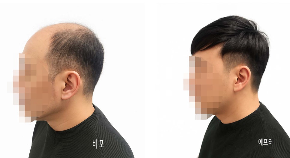 조이모 이미지
