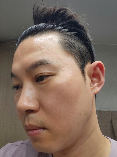 뷰드 이미지