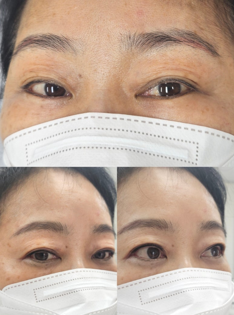 보니움 이미지