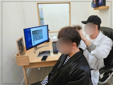 동탄탈모두피본연 이미지