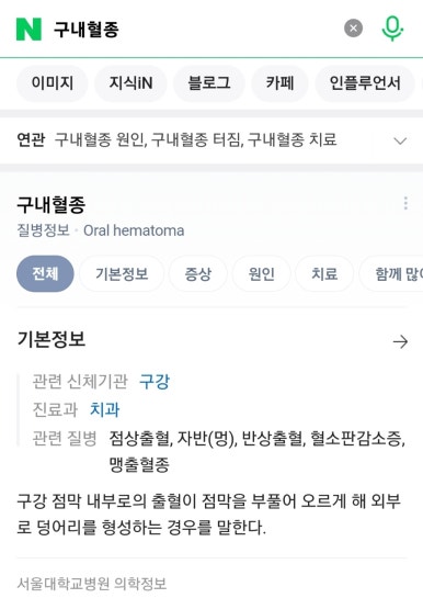 비선루 이미지