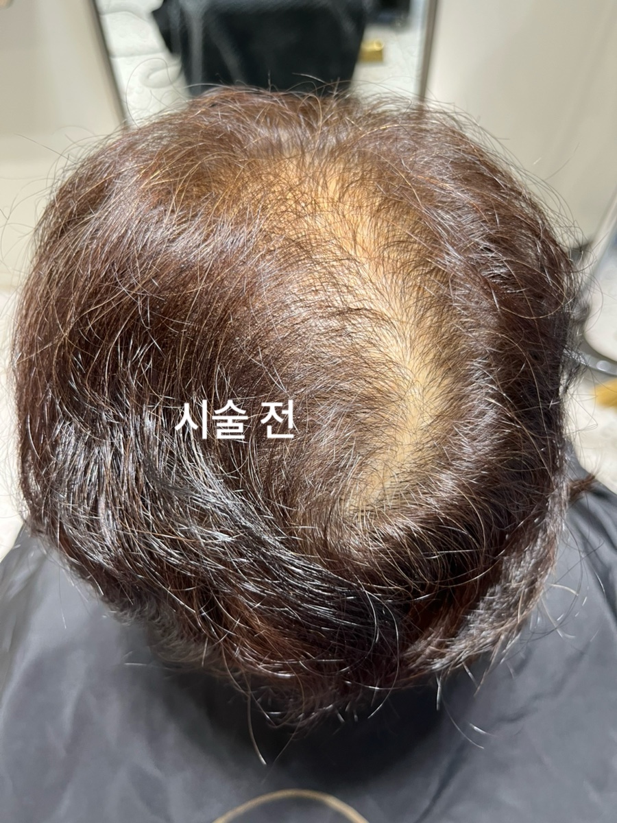 아이민헤어 이미지