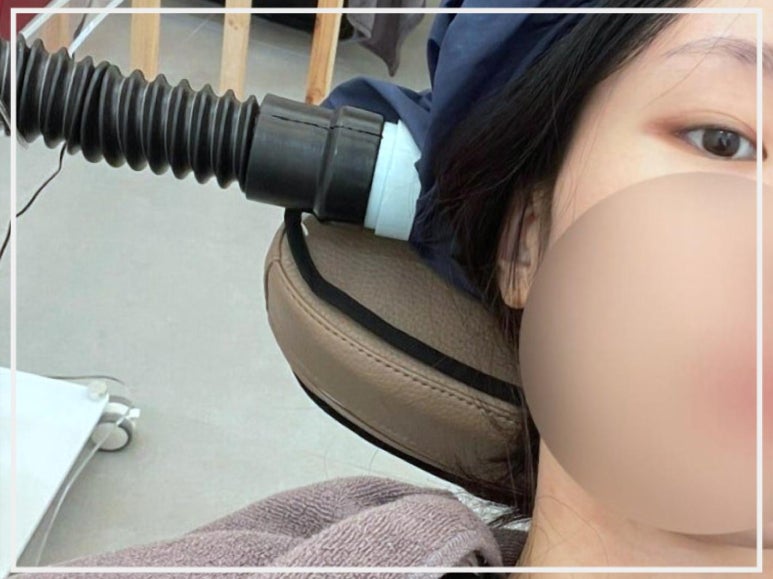 동탄탈모두피본연 이미지