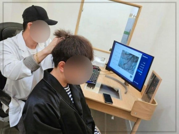 동탄탈모두피본연 이미지