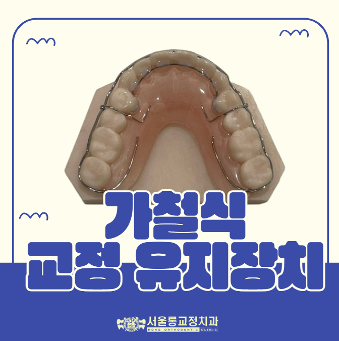[문정 교정치과] 교정 후 꼭 필요한 가철식 리테이너, 종류별 차이점 알아보기(Wraparound, Hawley, Spring ...