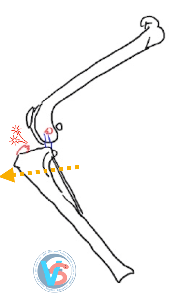 강아지 전십자인대 파열, TPLO 수술 비용과 회복 과정 — 사진 5