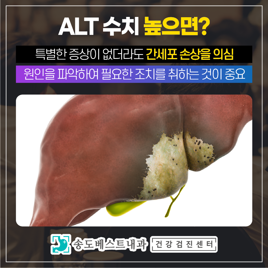 간장질환 ALT 수치 높으면 어떻게 될까? : 네이버 블로그