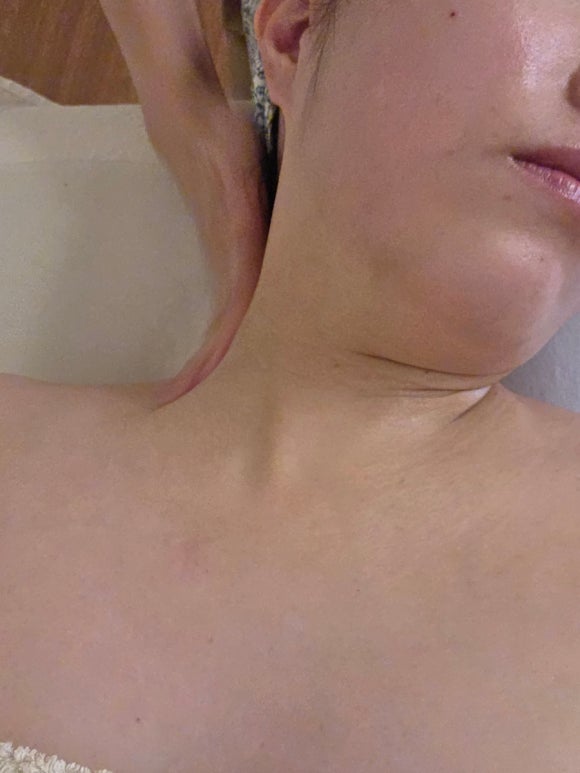 영통 청명 피부관리 진정재생관리 잘해주셨던 비엔비스킨케어 후기