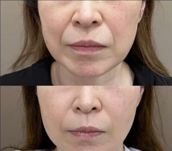 어머니 사진 전후.png