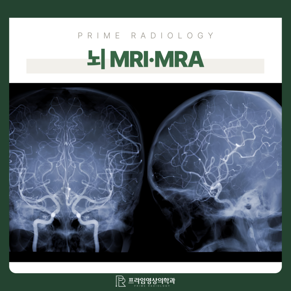40~50대라면 꼭 받아야 할 중년건강검진 추천: 뇌・저선량 흉부・복부 MRI・MRA・CT : 네이버 블로그