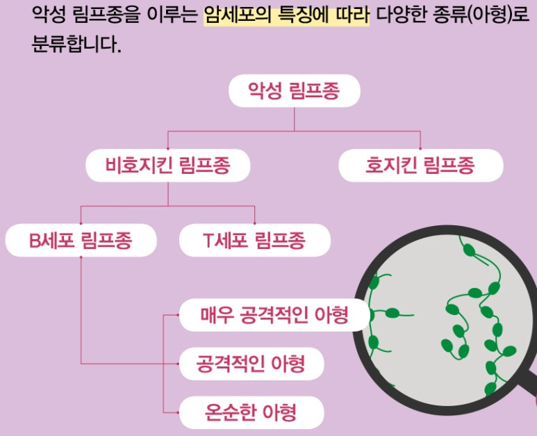 림프종 : 종류, 원인, 증상, 진단방법, 치료방법 : 네이버 블로그