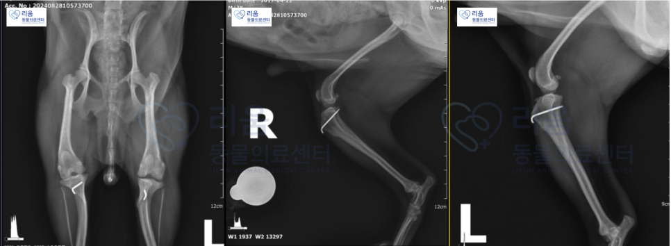 요크셔테리어 전십자인대 파열 TPLO 수술 비용 및 회복 과정 — 사진 6