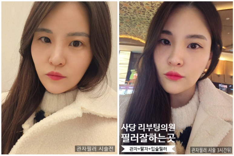 리부팅의원 이미지