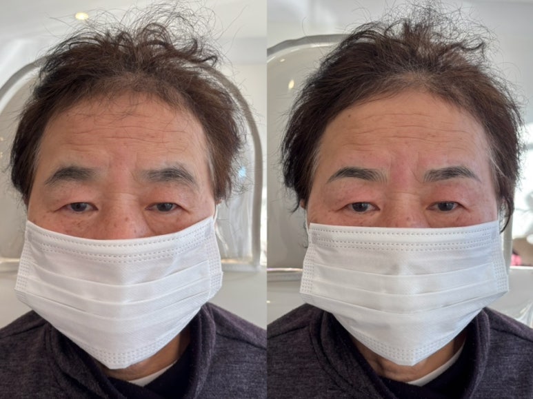 눈썹대장 이미지