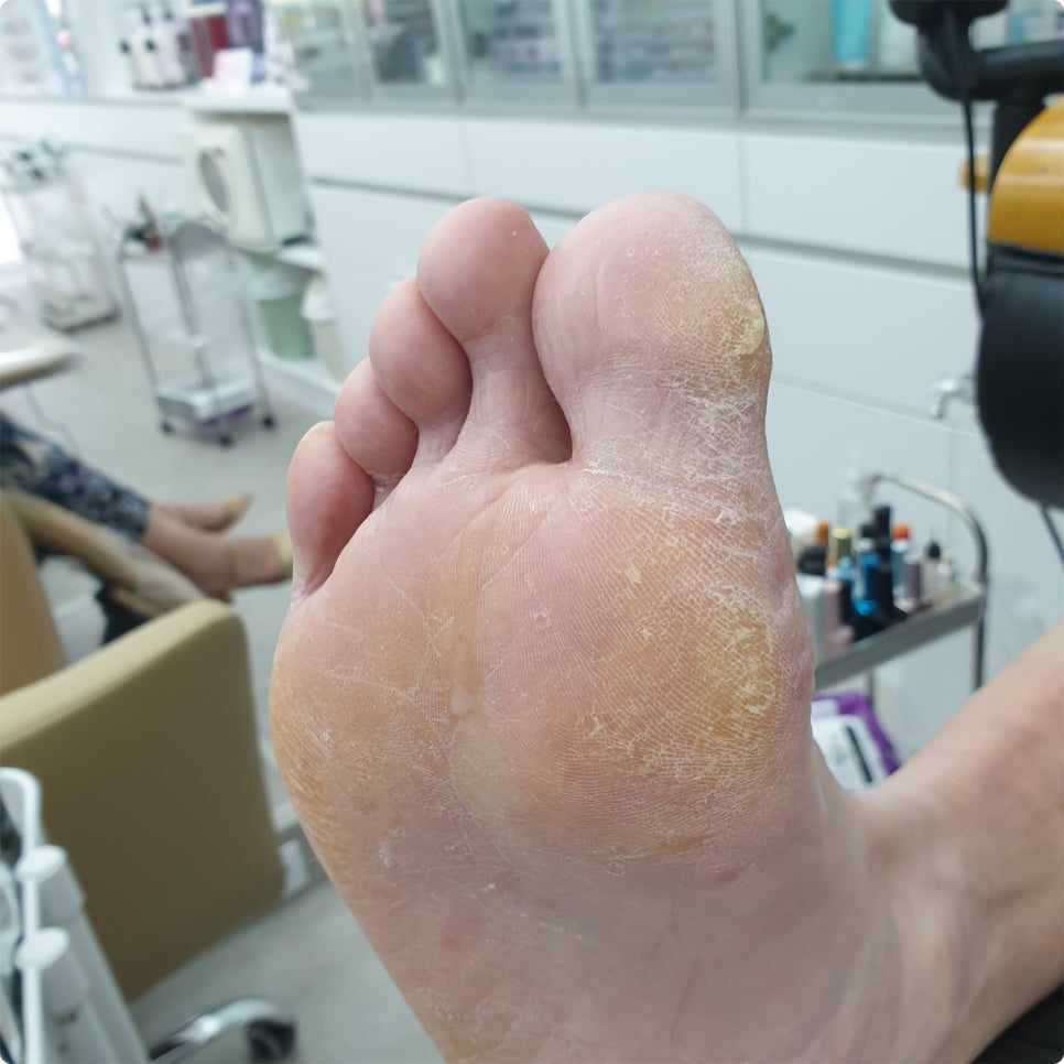 발라발라네일 이미지