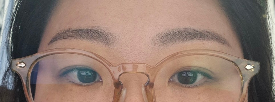 아르피온 이미지