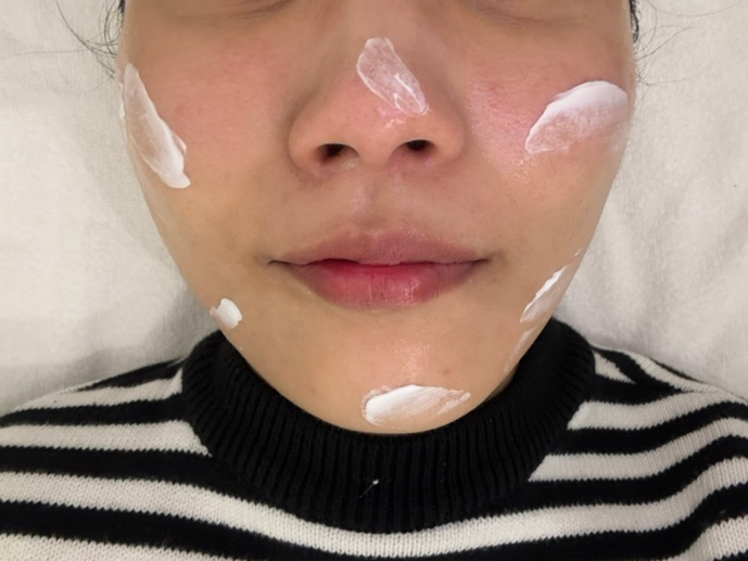 아누보스킨 이미지