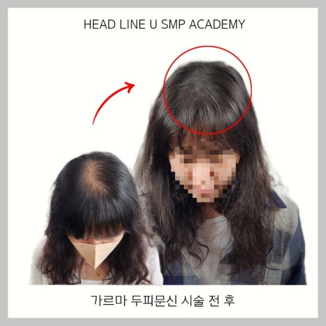 헤드라인유 이미지