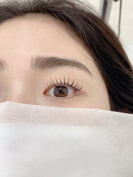 보니떼 이미지