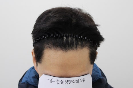 시그니처성형외과의원 이미지