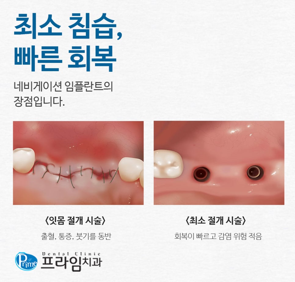 광교상현컴퓨터 이미지