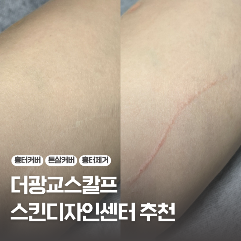 더광교스칼프스킨디자인센터 이미지