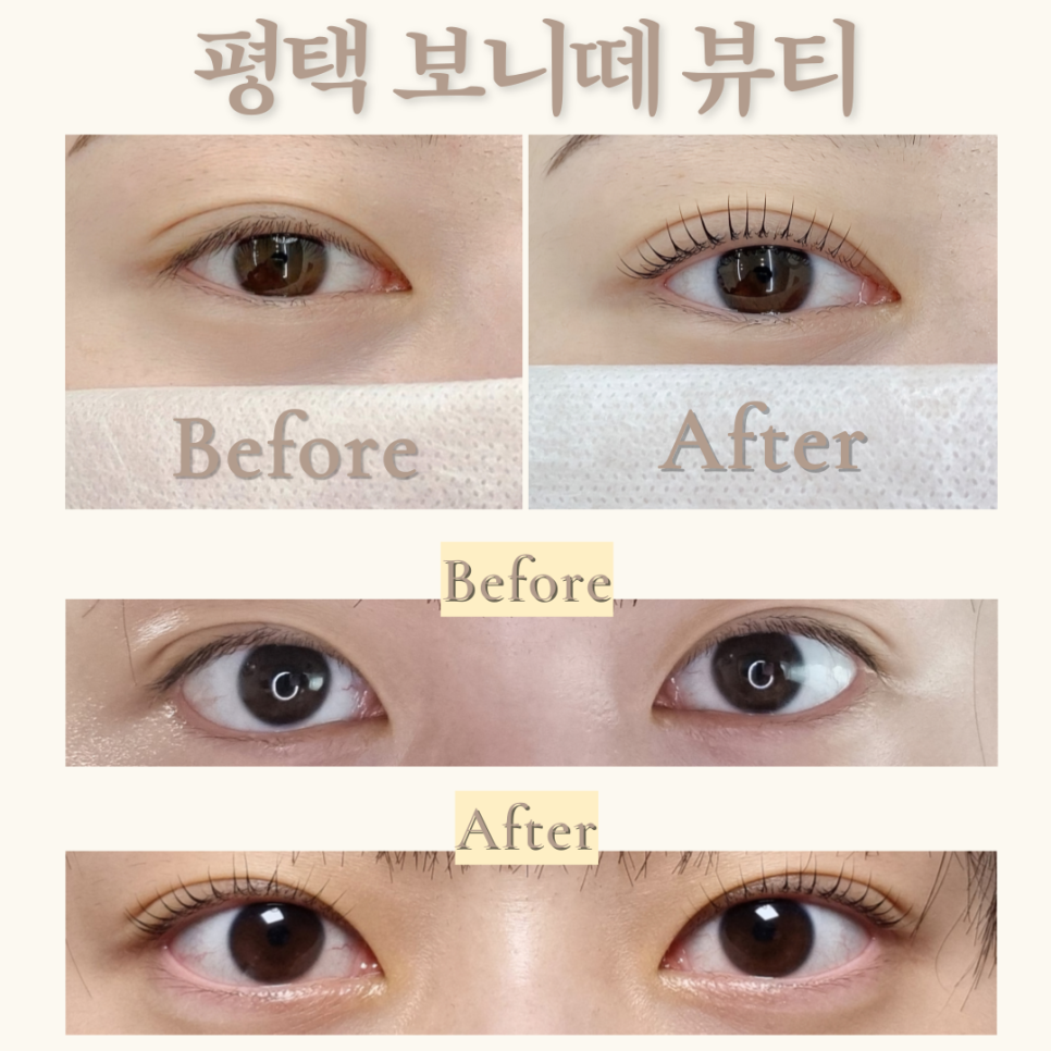 보니떼 이미지