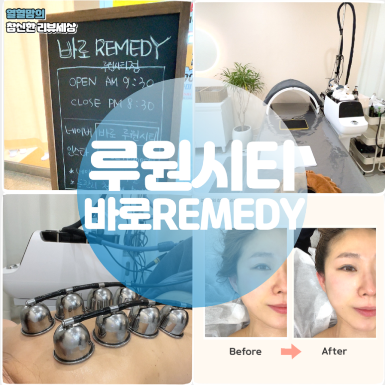 바로REMEDY루원시티점 이미지