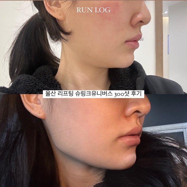 바노바기의원울산 이미지