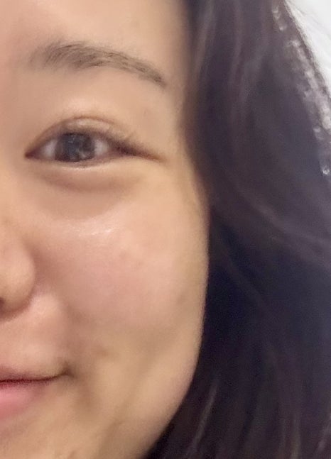 휴먼피부과의원 이미지
