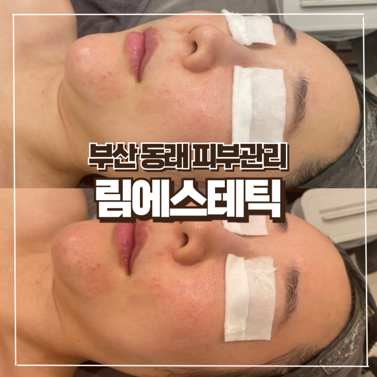 림에스테틱 이미지