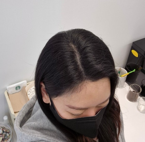 스칼프디자인센터마곡 이미지