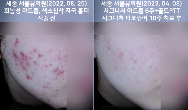 서울뷰의원 이미지