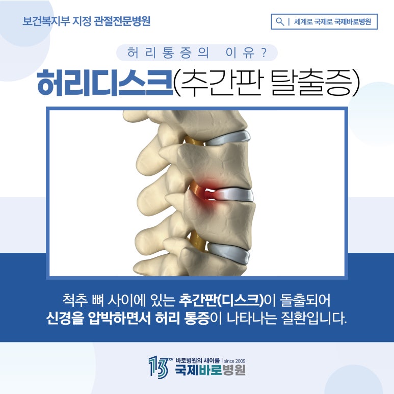 기둥병원 이미지
