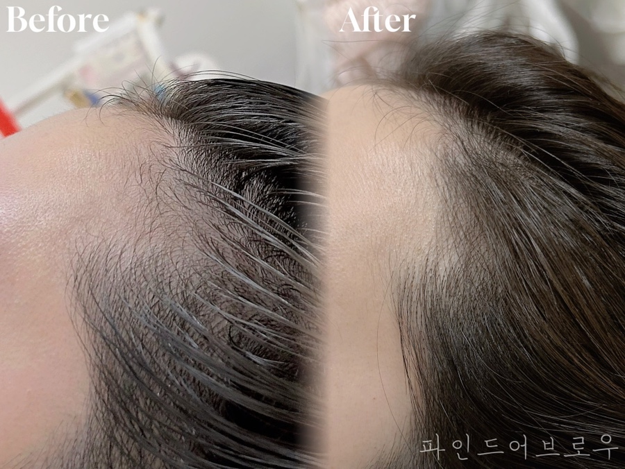 파인드헤어 이미지