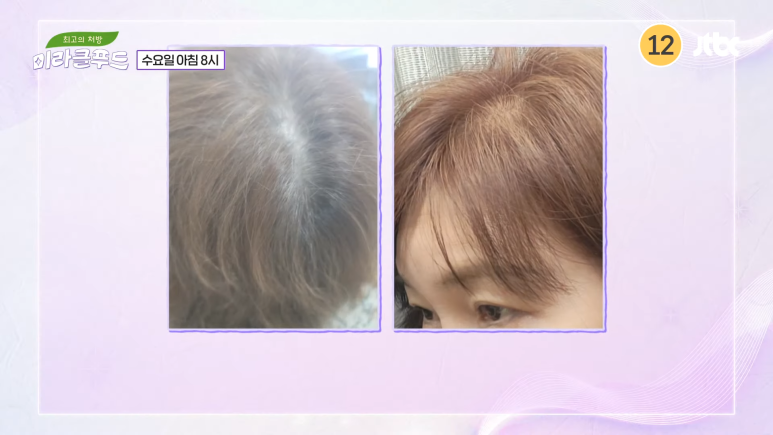미라클푸드 이미지