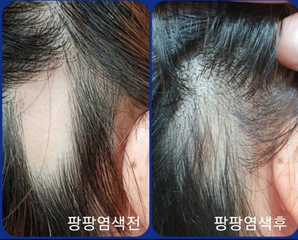 큐사랑 이미지