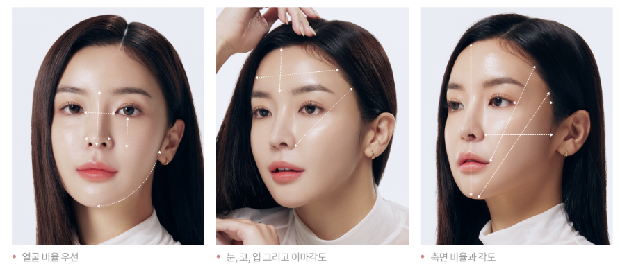 모모헤어라인 이미지