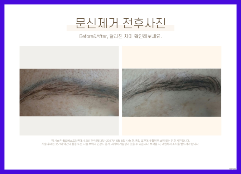 착한피부과 이미지