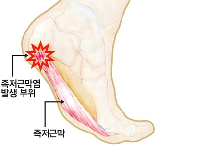 바디모어핏 이미지